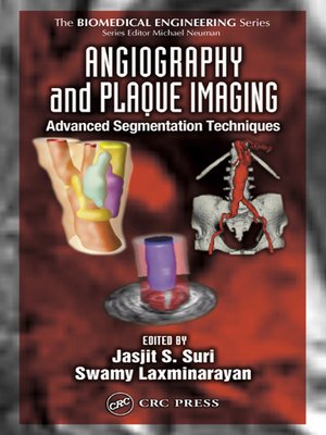 cover image of Angiography and Plaque Imaging